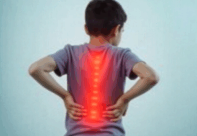 Dores Nas Costas Em Adolescentes: Causas Comuns