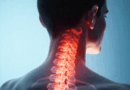 Como Identificar Problemas Na Coluna Cervical