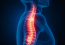 Osteoporose E Impacto Na Coluna Vertebral